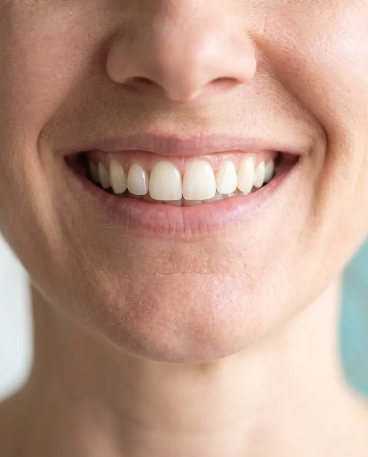 Close-up of a natural, healthy smile